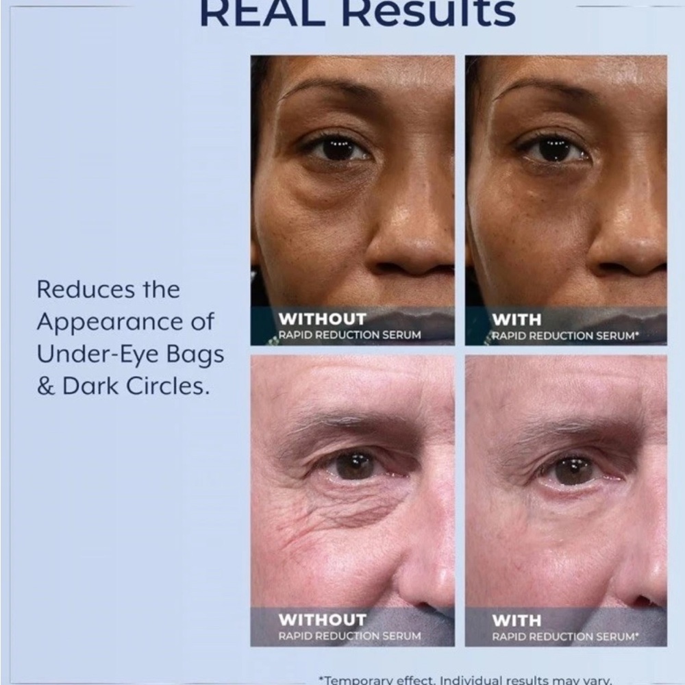 Plexaderm Rapid Reduction Serum under eye bags and wrinkles - Picture 3 of 6